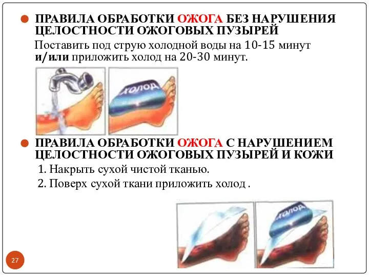 ПРАВИЛА ОБРАБОТКИ ОЖОГА БЕЗ НАРУШЕНИЯ ЦЕЛОСТНОСТИ ОЖОГОВЫХ ПУЗЫРЕЙ Поставить под струю