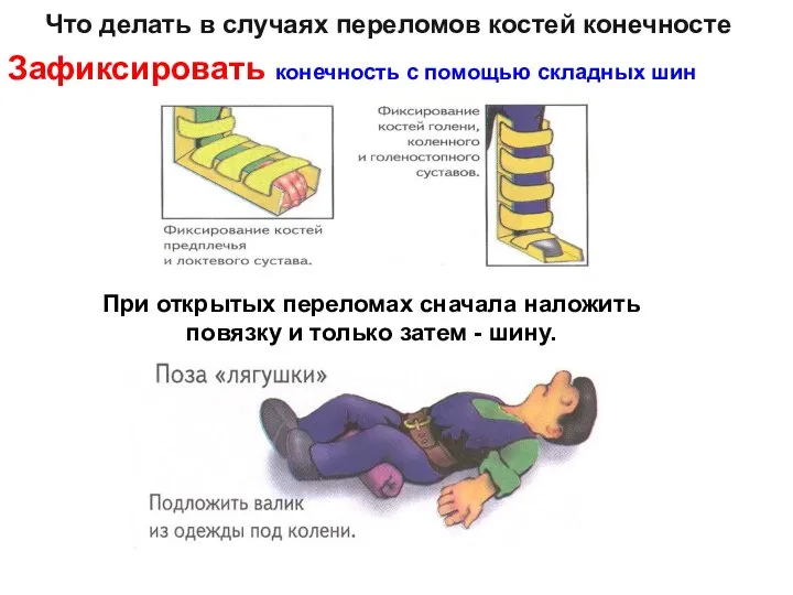 Что делать в случаях переломов костей конечностей Зафиксировать конечность с помощью