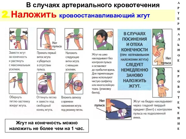 В случаях артериального кровотечения 2. Наложить кровоостанавливающий жгут А Р Т