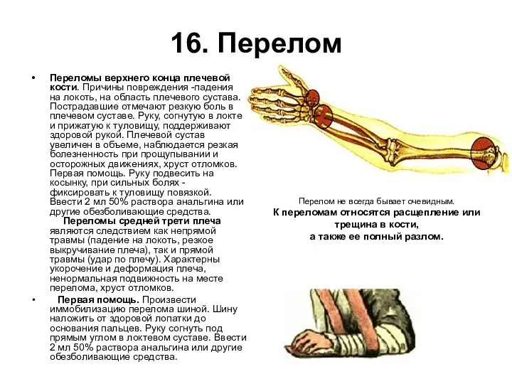 16. Перелом Переломы верхнего конца плечевой кости. Причины повреждения -падения на