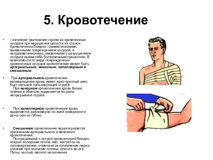 5. Кровотечение - излияние (вытекание) крови из кровеносных сосудов при нарушении