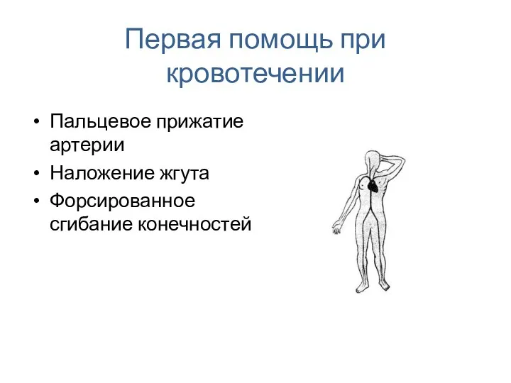 Первая помощь при кровотечении Пальцевое прижатие артерии Наложение жгута Форсированное сгибание конечностей