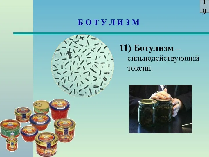 Б О Т У Л И З М 11) Ботулизм – сильнодействующий токсин. 19