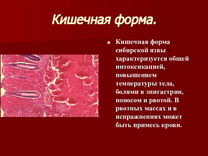 Кишечная форма. Кишечная форма сибирской язвы характеризуется общей интоксикацией, повышением температуры