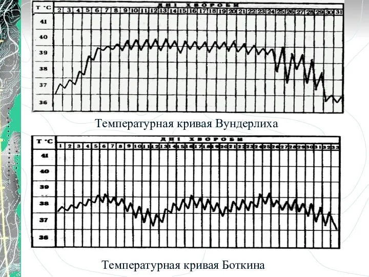 Температурная кривая Вундерлиха Температурная кривая Боткина