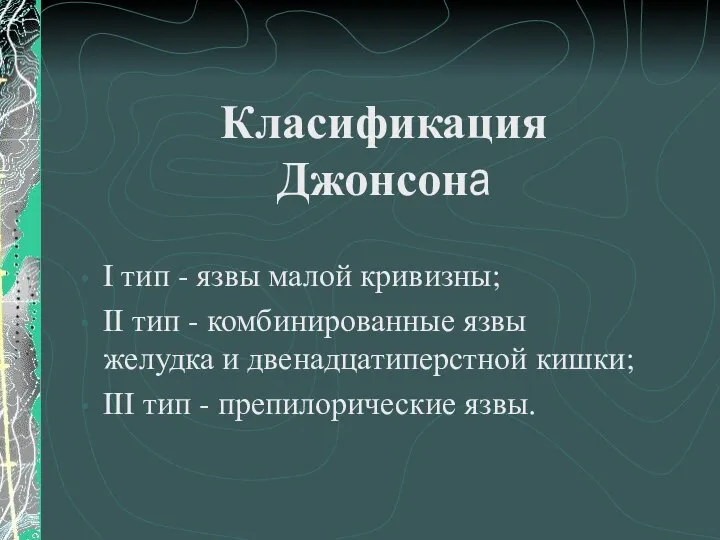 Класификация Джонсона I тип - язвы малой кривизны; II тип -