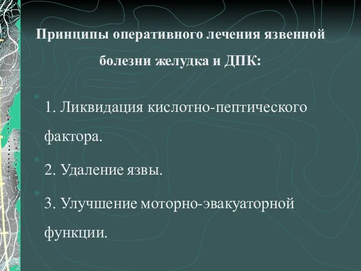 Принципы оперативного лечения язвенной болезни желудка и ДПК: 1. Ликвидация кислотно-пептического