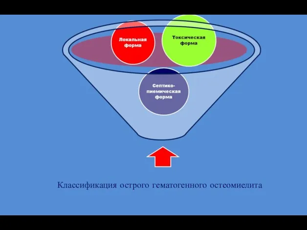 Классификация острого гематогенного остеомиелита