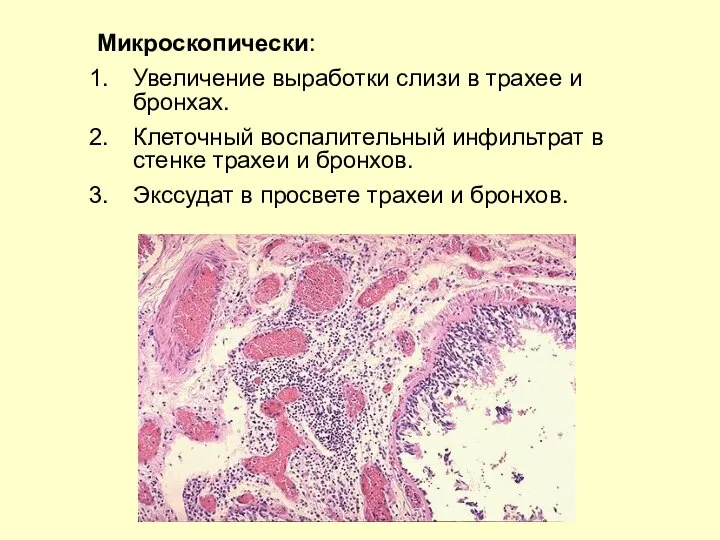 Микроскопически: Увеличение выработки слизи в трахее и бронхах. Клеточный воспалительный инфильтрат