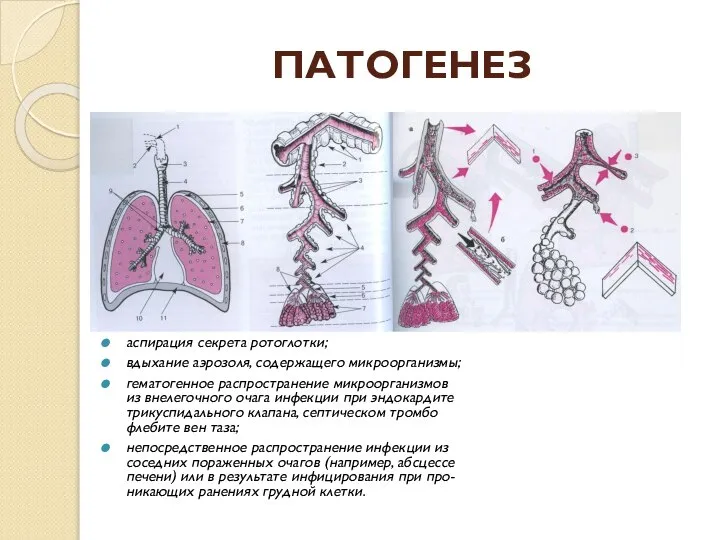 аспирация секрета ротоглотки; вдыхание аэрозоля, содержащего микроорганизмы; гематогенное распространение микроорганизмов из