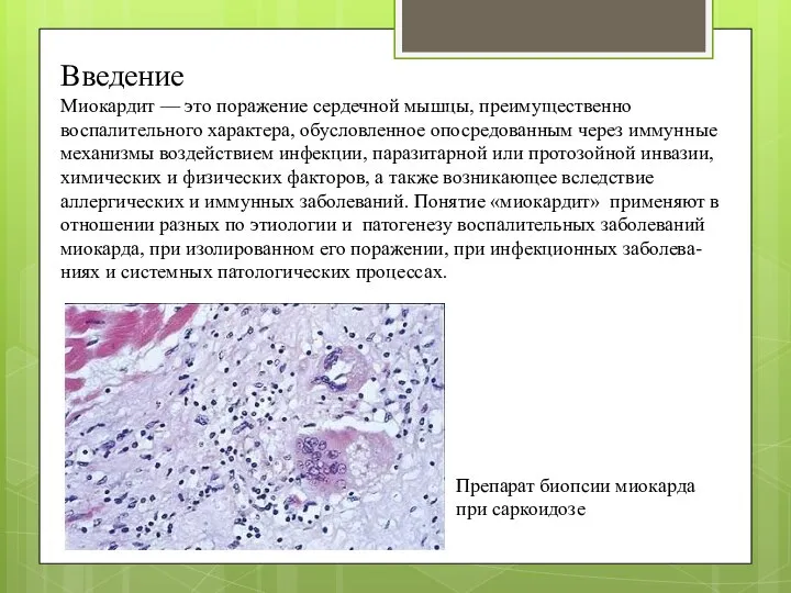 Введение Миокардит — это поражение сердечной мышцы, преимущественно воспалительного характера, обусловленное