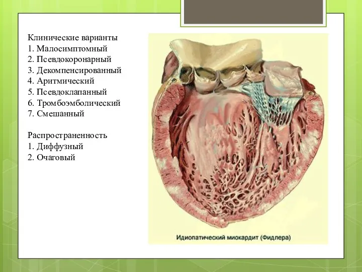 Клинические варианты 1. Малосимптомный 2. Псевдокоронарный 3. Декомпенсированный 4. Аритмический 5.