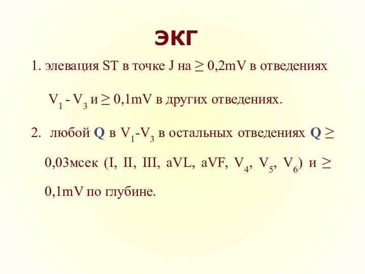 ЭКГ 1. элевация ST в точке J на ≥ 0,2mV в