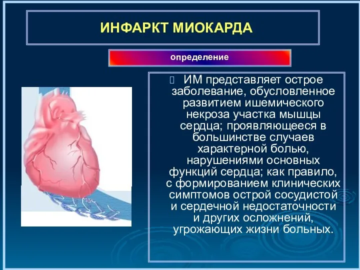 ИНФАРКТ МИОКАРДА ИМ представляет острое заболевание, обусловленное развитием ишемического некроза участка