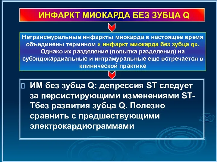 ИНФАРКТ МИОКАРДА БЕЗ ЗУБЦА Q ИМ без зубца Q: депрессия ST