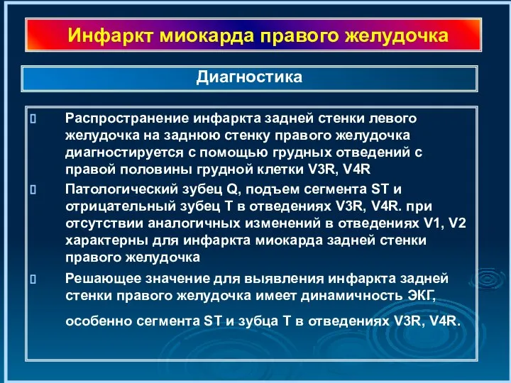 Инфаркт миокарда правого желудочка Распространение инфаркта задней стенки левого желудочка на