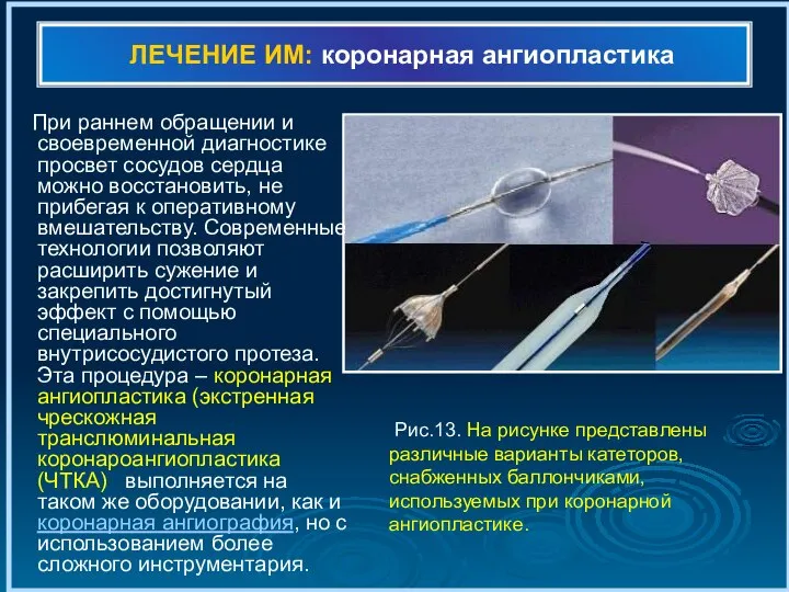 ЛЕЧЕНИЕ ИМ: коронарная ангиопластика При раннем обращении и своевременной диагностике просвет