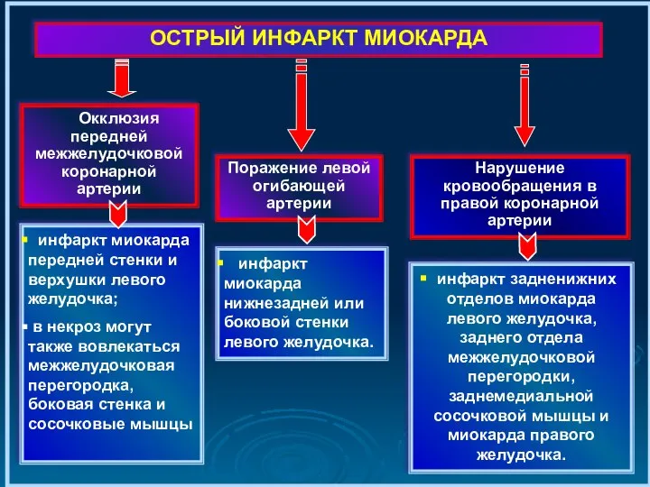 Окклюзия передней межжелудочковой коронарной артерии ОСТРЫЙ ИНФАРКТ МИОКАРДА Поражение левой огибающей