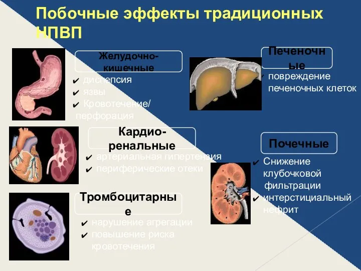 Побочные эффекты традиционных НПВП