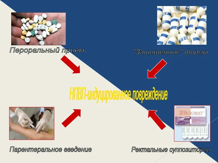 НПВП-индуцированное повреждение Пероральный прием "Защищенные" формы Парентеральное введение Ректальные суппозитории