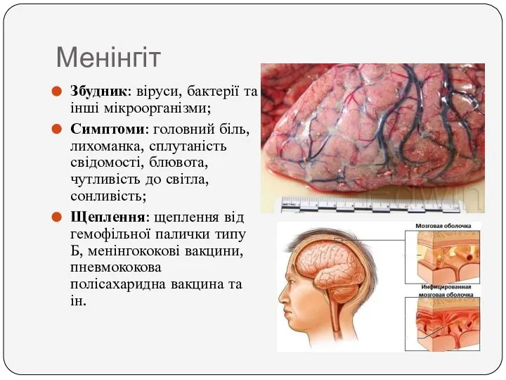 Менінгіт Збудник: віруси, бактерії та інші мікроорганізми; Симптоми: головний біль, лихоманка,