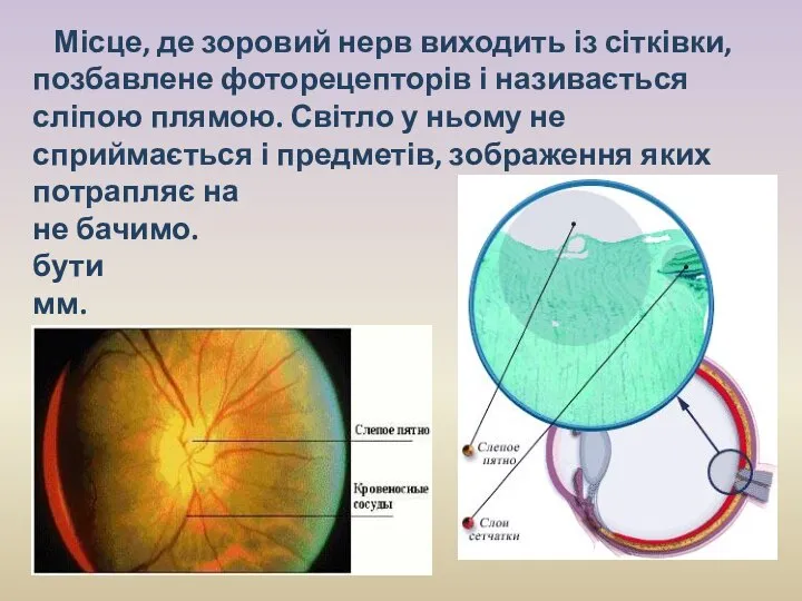 Місце, де зоровий нерв виходить із сітківки, позбавлене фоторецепторів і називається