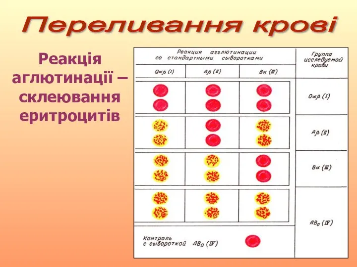 Переливання крові Реакція аглютинації – склеювання еритроцитів