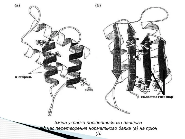 Зміна укладки поліпептидного ланцюга під час перетворення нормального балка (а) на пріон (b)