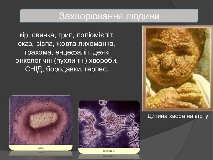 кір, свинка, грип, поліомієліт, сказ, віспа, жовта лихоманка, трахома, енцефаліт, деякі