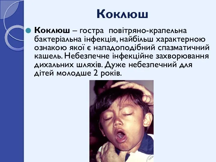 Коклюш Коклюш – гостра повітряно-крапельна бактеріальна інфекція, найбільш характерною ознакою якої