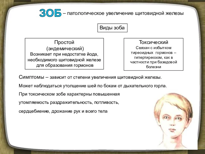 – патологическое увеличение щитовидной железы Простой (эндемический) Возникает при недостатке йода,