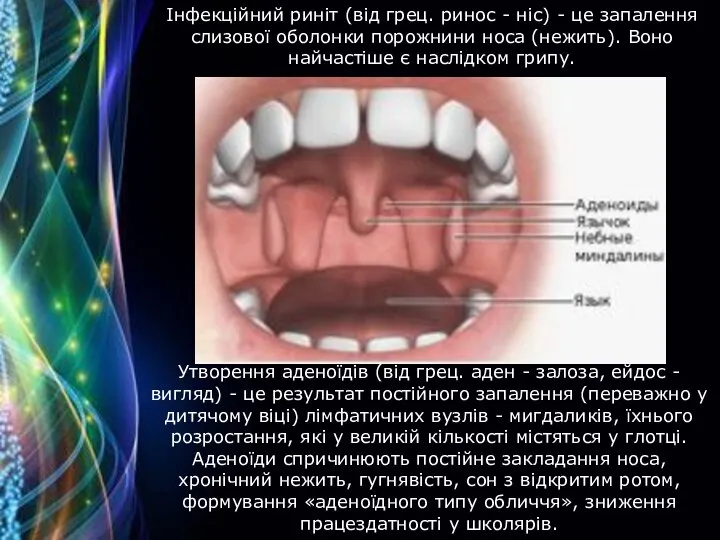 Інфекційний риніт (від грец. ринос - ніс) - це запалення слизової