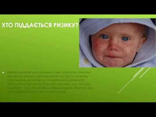 Хто піддається ризику? Невакциновані діти раннього віку зазнають самому високому ризику