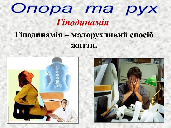 Гіподинамія – малорухливий спосіб життя. Опора та рух Гіподинамія