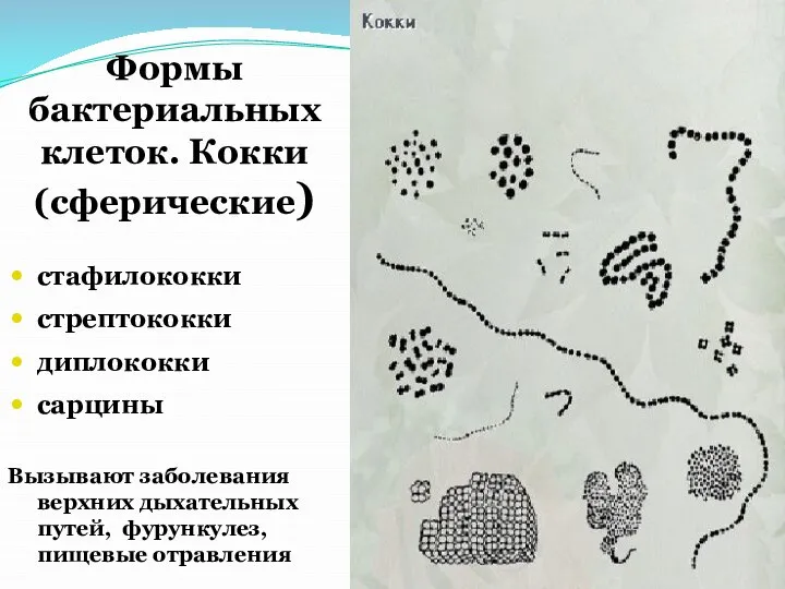 Формы бактериальных клеток. Кокки (сферические) стафилококки стрептококки диплококки сарцины Вызывают заболевания