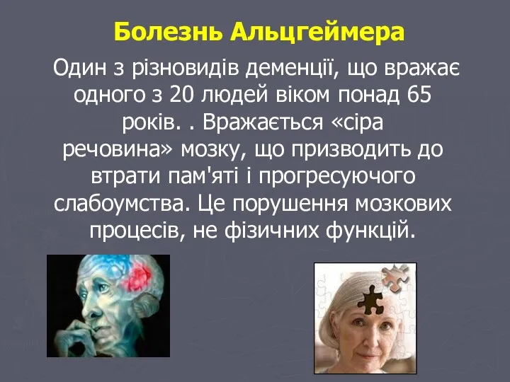 Болезнь Альцгеймера Один з різновидів деменції, що вражає одного з 20