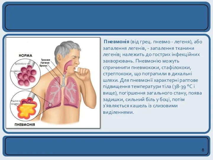 Пневмонія (від грец. пневмо - легеня), або запалення легенів, - запалення