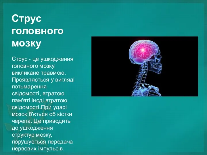 Струс головного мозку Струс - це ушкодження головного мозку, викликане травмою.