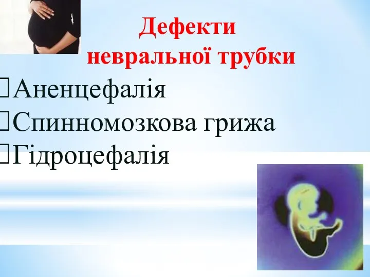 Дефекти невральної трубки Аненцефалія Спинномозкова грижа Гідроцефалія