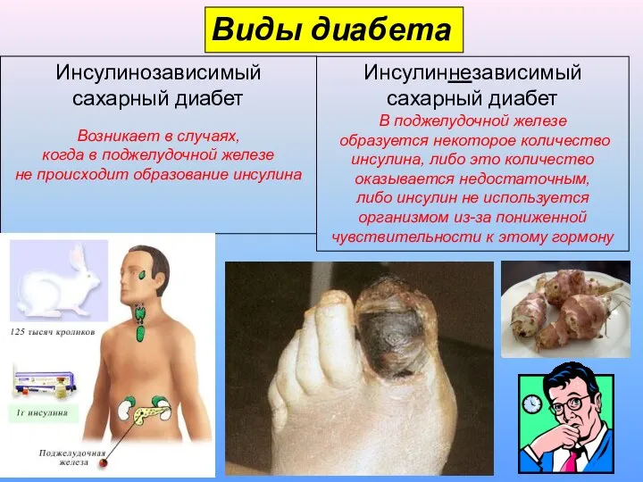 Виды диабета Инсулинозависимый сахарный диабет Возникает в случаях, когда в поджелудочной