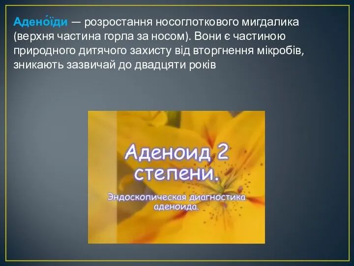 Адено́їди — розростання носоглоткового мигдалика (верхня частина горла за носом). Вони