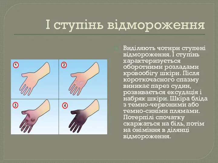 І ступінь відмороження Виділяють чотири ступені відмороження. І ступінь характеризується оборотними