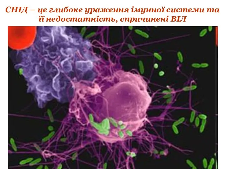 СНІД – це глибоке ураження імунної системи та її недостатність, спричинені ВІЛ