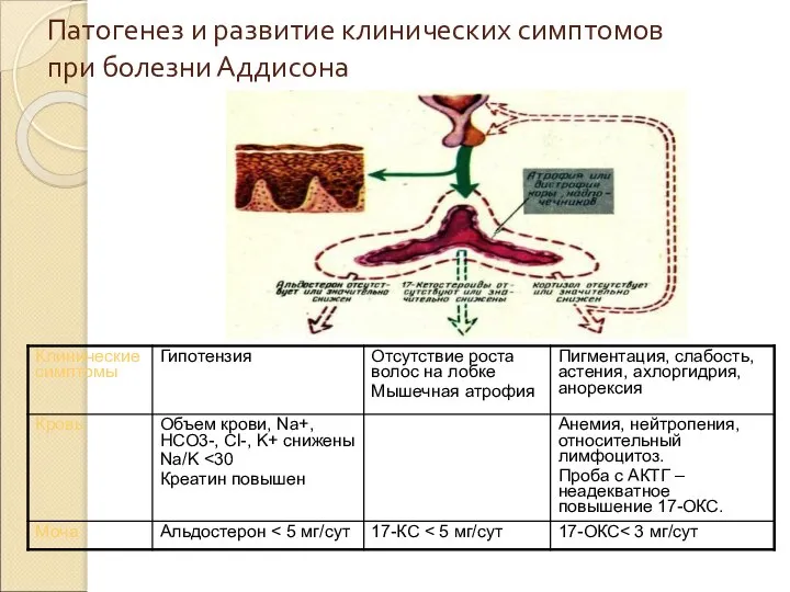 Патогенез и развитие клинических симптомов при болезни Аддисона