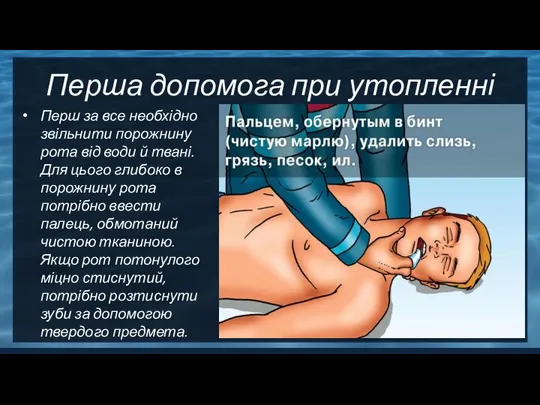 Перша допомога при утопленні Перш за все необхідно звільнити порожнину рота