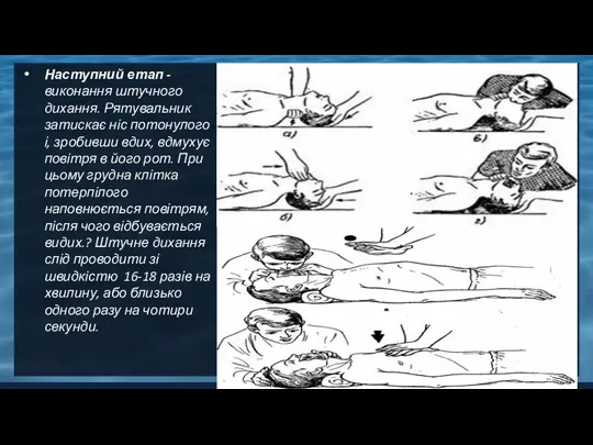 Наступний етап - виконання штучного дихання. Рятувальник затискає ніс потонулого і,