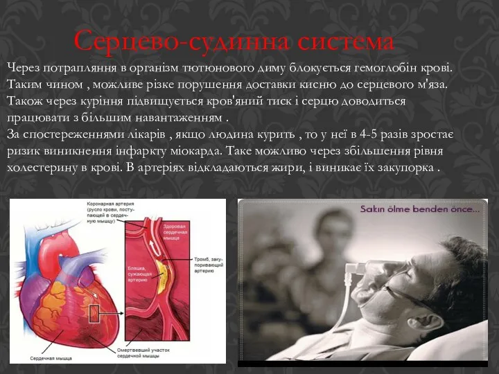 Серцево-судинна система Через потрапляння в організм тютюнового диму блокується гемоглобін крові.