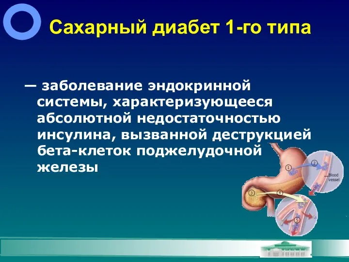 Сахарный диабет 1-го типа — заболевание эндокринной системы, характеризующееся абсолютной недостаточностью