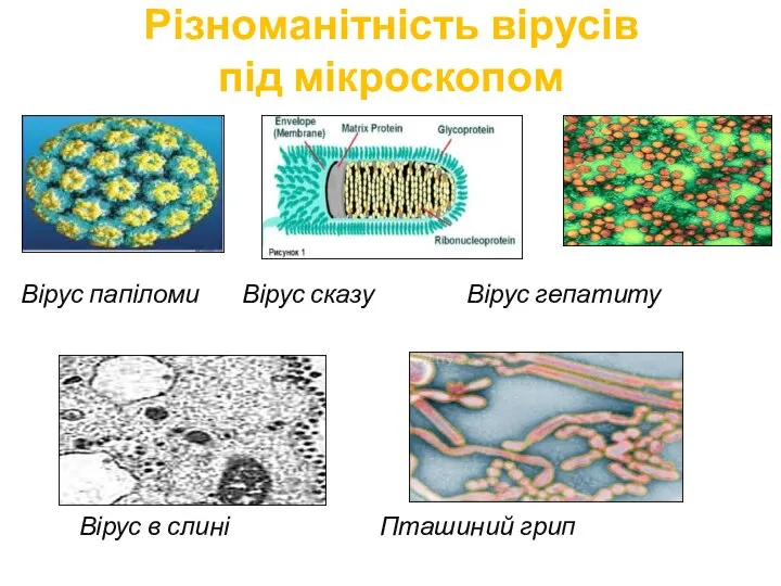 Різноманітність вірусів під мікроскопом Вірус папіломи Вірус сказу Вірус гепатиту Вірус в слині Пташиний грип