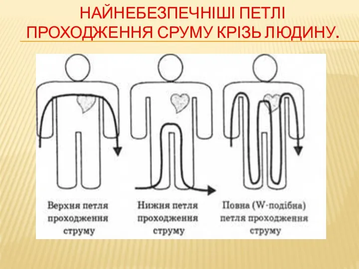 Найнебезпечніші петлі проходження сруму крізь людину.